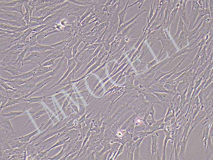 子宫内膜细胞细胞图片