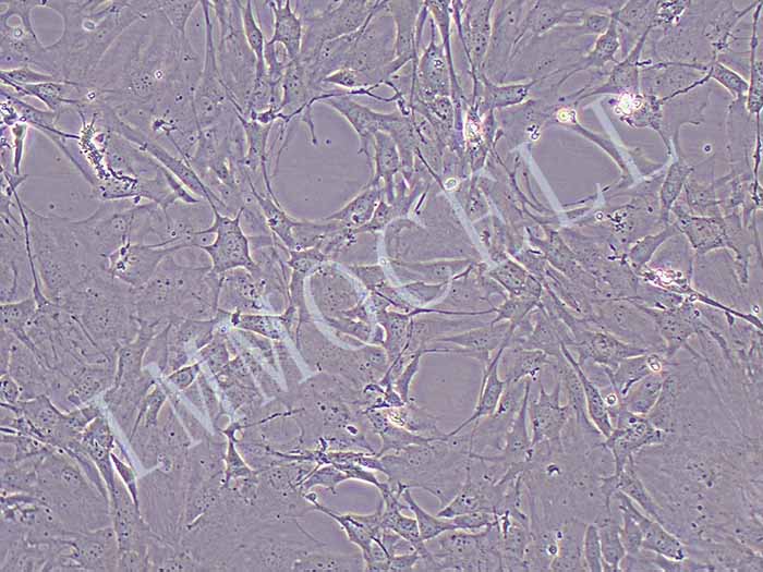 小鼠骨髓间充质干细胞永生化图片