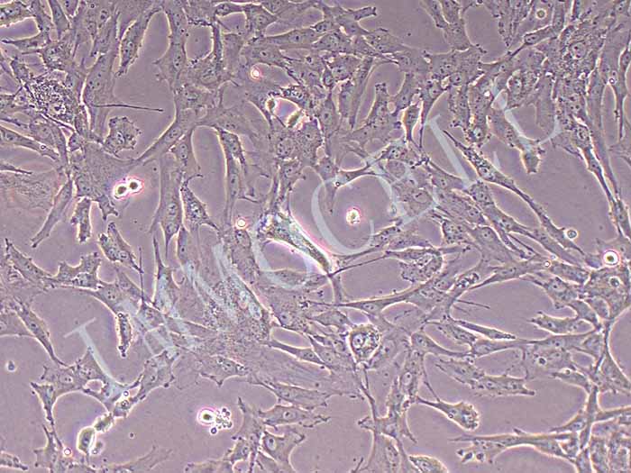 猪主动脉平滑肌细胞永生化-largeT