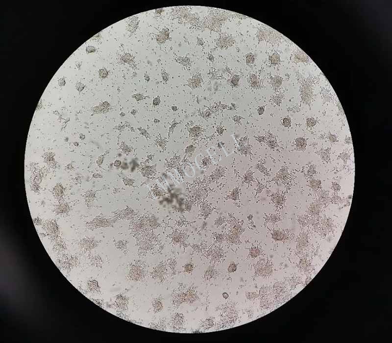 SH-SY5Y细胞出现成团图片