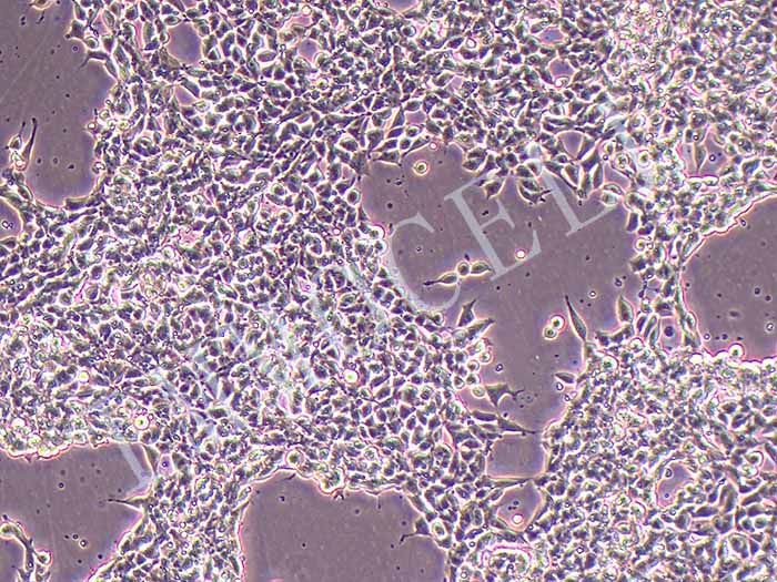 SK-NEP-1细胞细胞图片