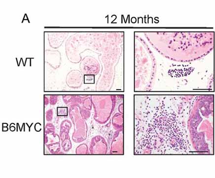 第十课：建立C57BL/6 背景的MYC诱导的前列腺肿瘤的小鼠模型和细胞系