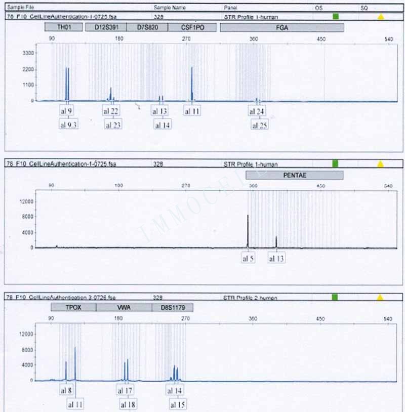 SK-OV-3人卵巢癌细胞STR位点图