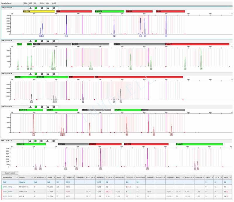 MHCC-97H人高转移性肝癌细胞STR鉴定位点图