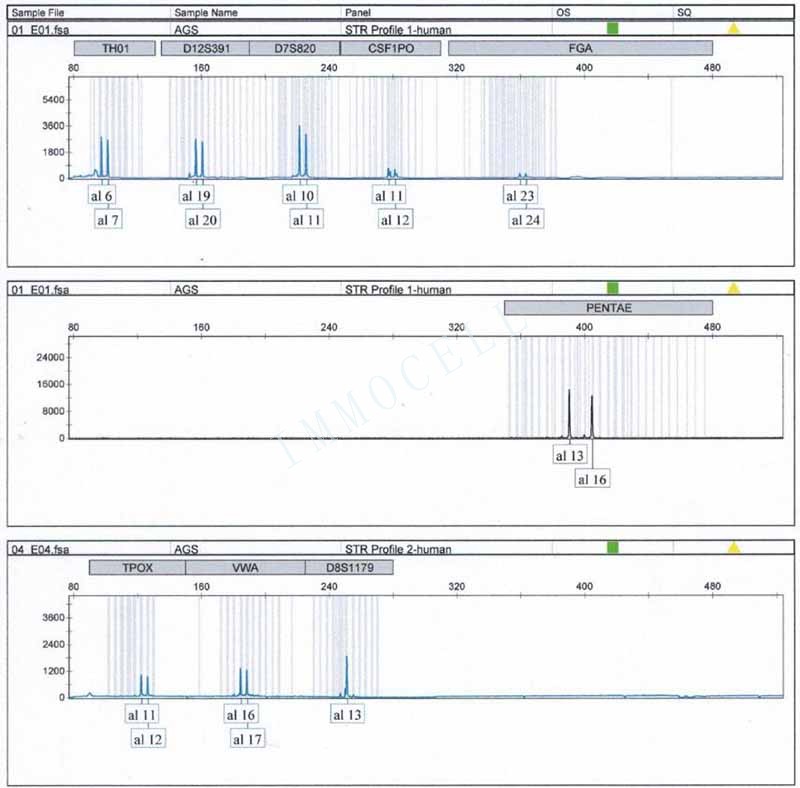AGS人胃腺癌细胞STR鉴定位点图片