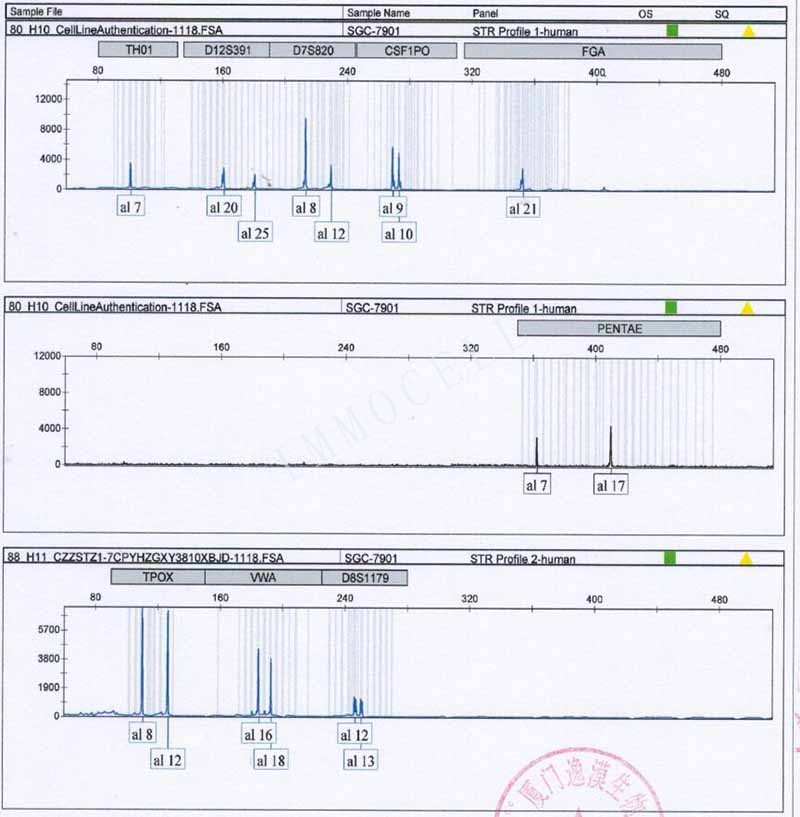 SGC-7901人胃腺癌细胞STR鉴定位点图