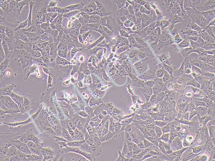 143B-LUC细胞图片