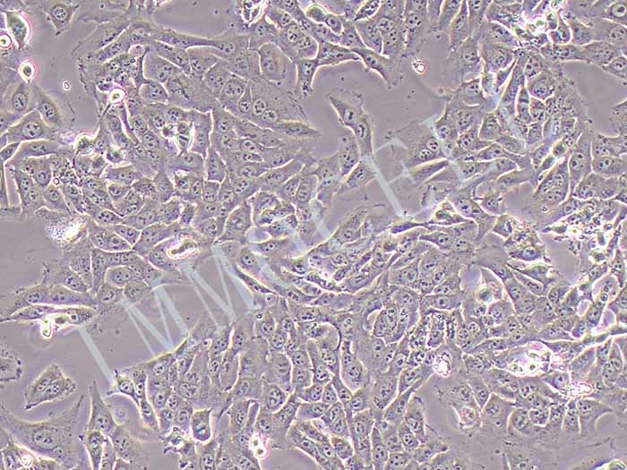 143B-LUC细胞细胞图片