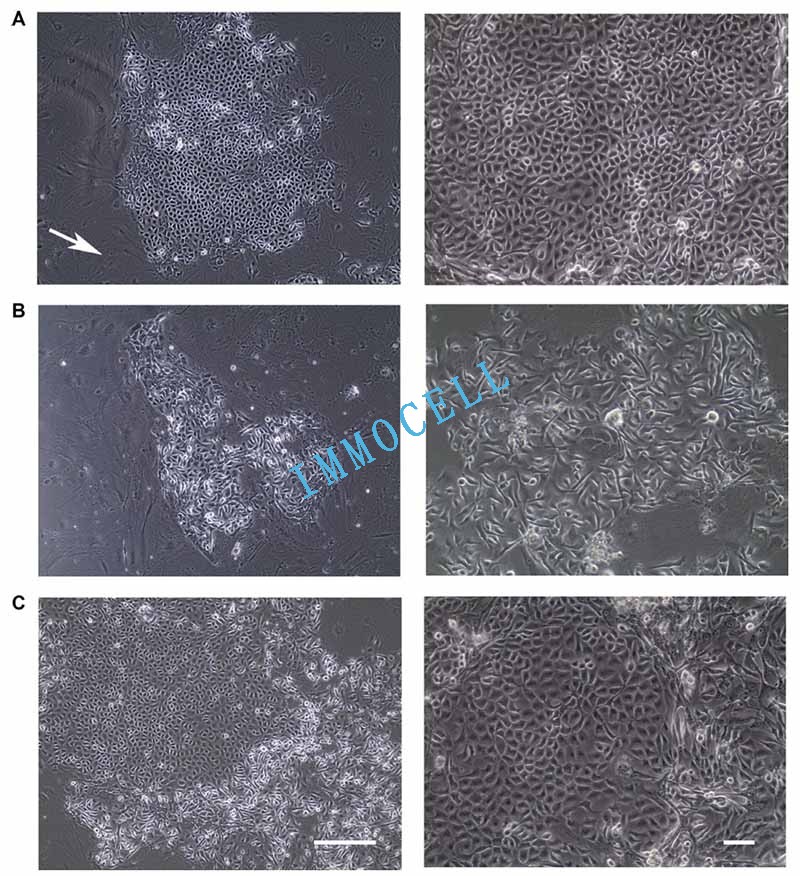 一、条件性重编程培养的乳腺表皮细胞的形态学特征图