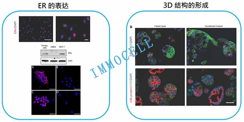 条件性重编程培养的原代人的乳腺表皮细胞的鉴定总结图