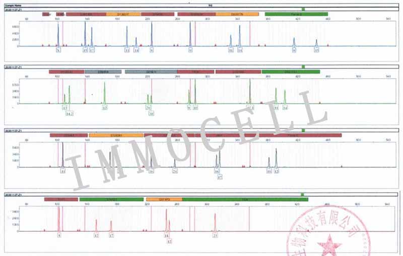 A375人恶性黑色素瘤细胞STR鉴定图片