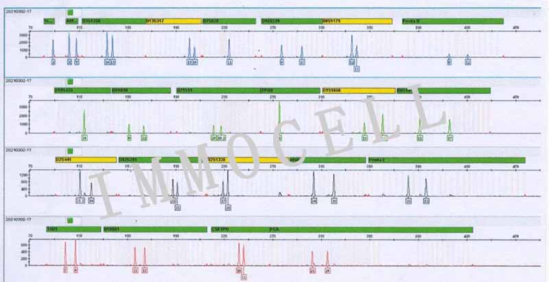 A2058人皮肤癌细胞STR鉴定图片