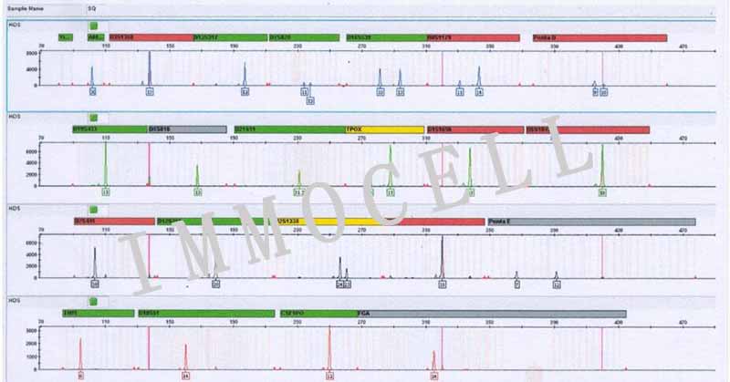HOS人骨肉瘤细胞STR鉴定图片