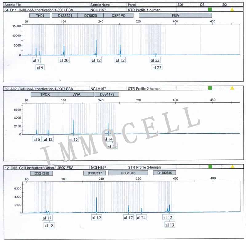 NCI-H157人非小细胞肺腺癌细胞STR鉴定图片