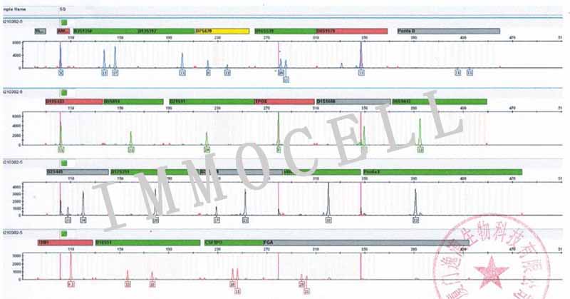 RD人恶性胚胎横纹肌瘤细胞STR鉴定图片