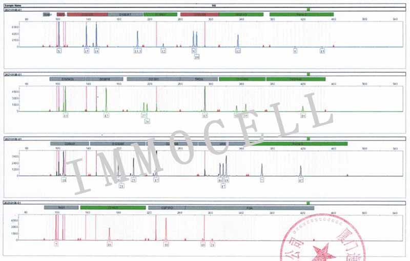 THP-1人单核细胞白血病细胞STR鉴定图片