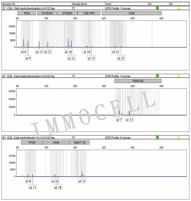 TT人髓样甲状腺肿瘤细胞STR鉴定图片