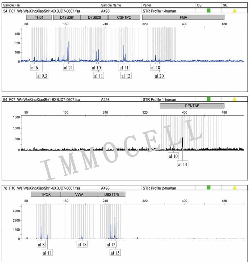 A498人肾癌细胞STR鉴定图片