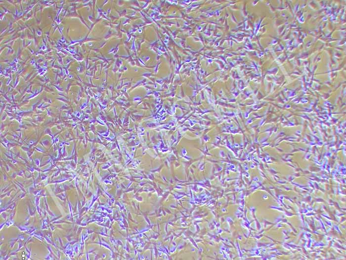 人骨髓间充质干细胞