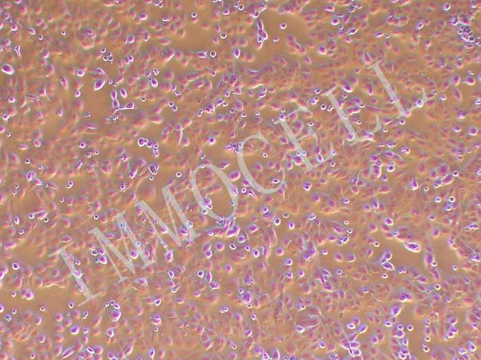 HCC94细胞细胞图片