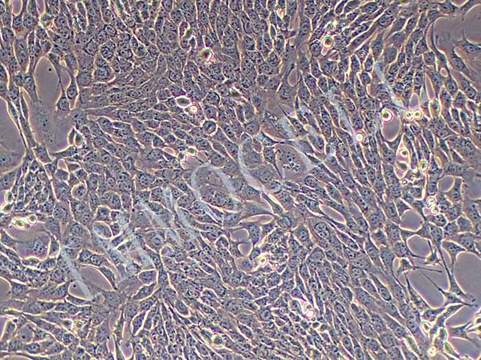 OVCAR-8细胞图片