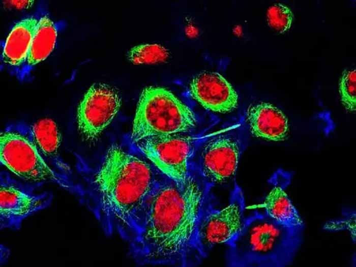 Hela细胞（海拉细胞系百科）