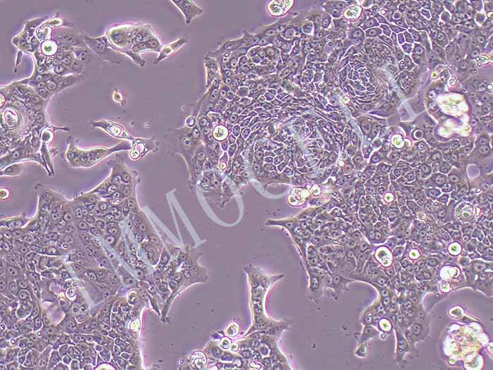 capan-1/GEM人胰腺癌细胞吉西他滨耐药株