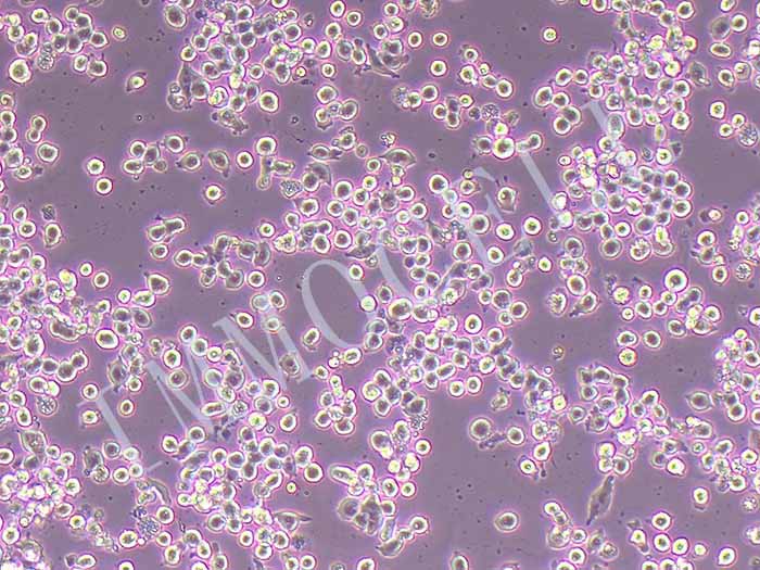 MIA-PACA-2/GEM人胰腺癌细胞吉西他滨耐药株