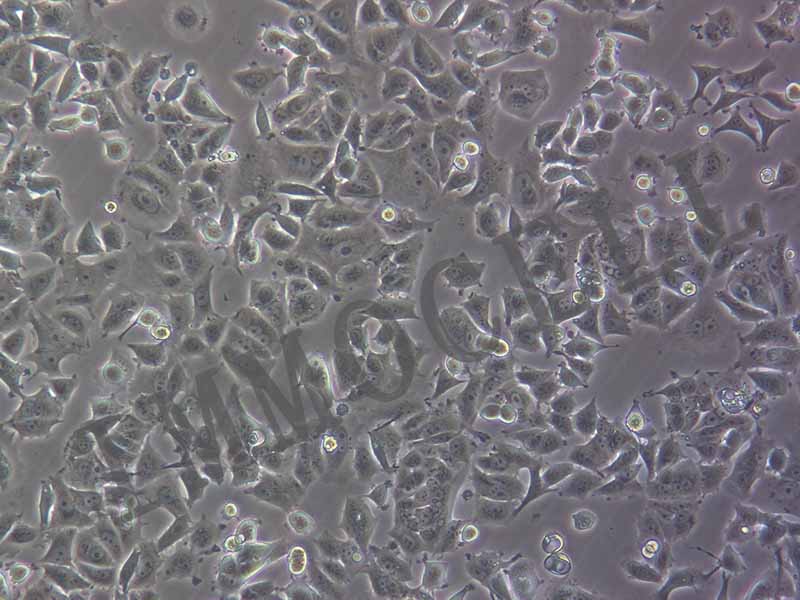 逸漠细胞库MCF-7细胞图片