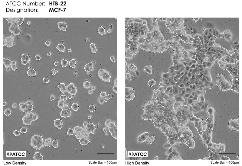 ATCC细胞库MCF-7细胞图片