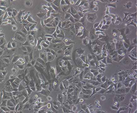 MCF-7细胞培养条件及注意事项