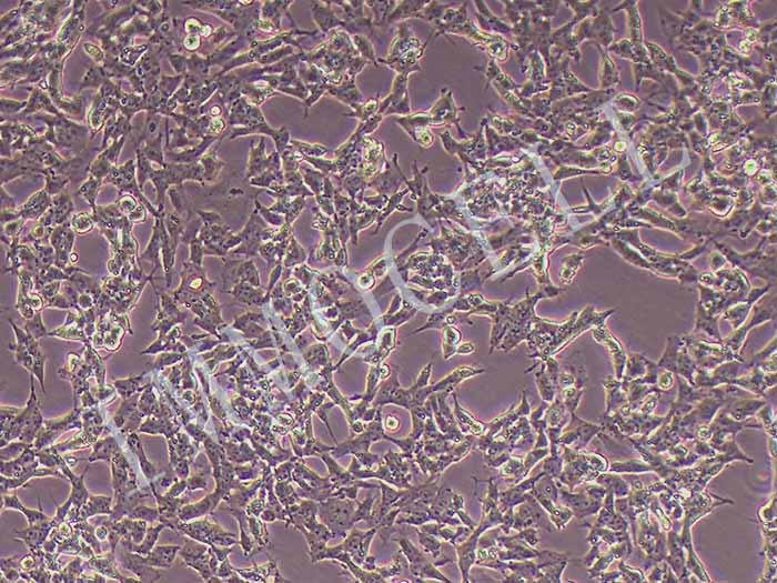 SK-N-BE(2) 人神经母细胞瘤细胞（STR鉴定正确）