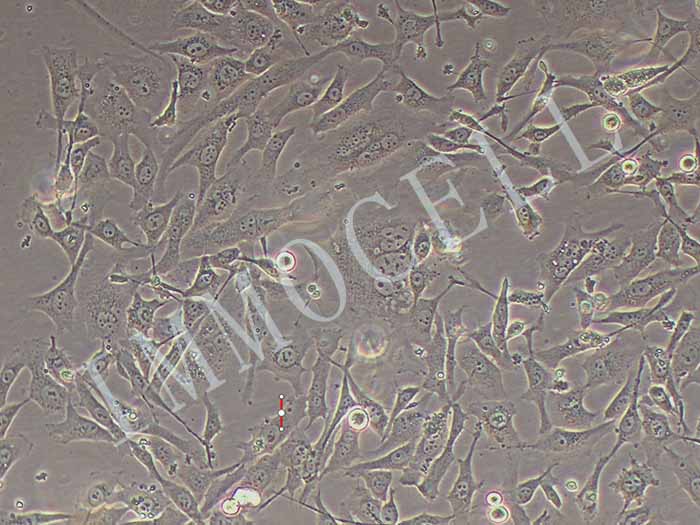 HS-5人骨髓基质细胞