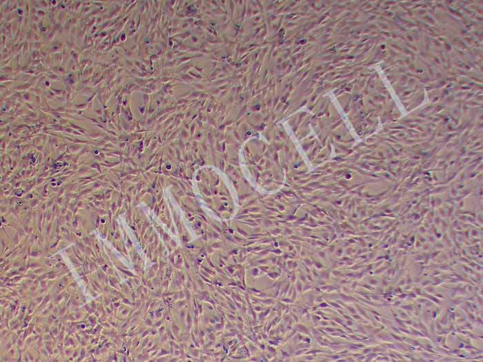 人风湿性关节滑膜成纤维细胞永生化（免疫荧光鉴定）