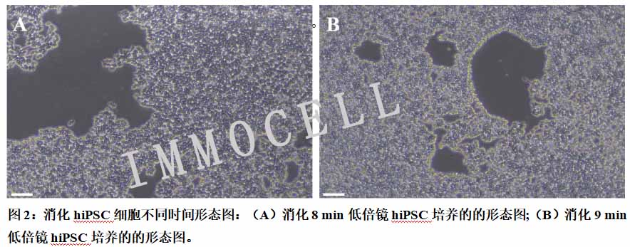 消化hiPSC细胞不同时间形态图