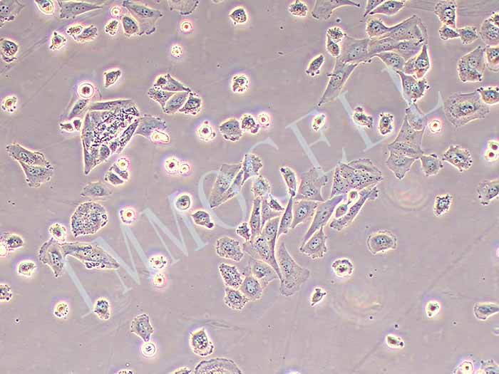 Saos-2细胞图片