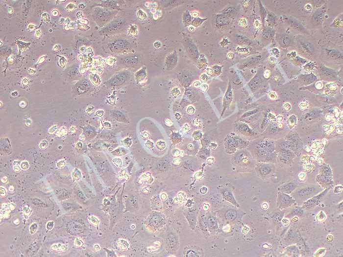 SAOS-2-LUC细胞图片