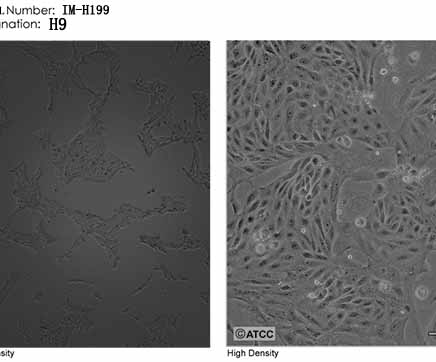 H9人胚胎干细胞培养条件与方法