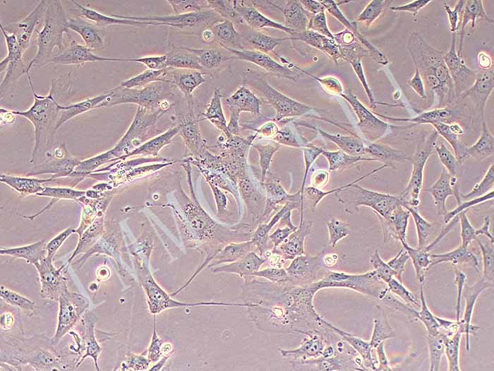 人卵巢癌相关成纤维细胞永生化（免疫荧光鉴定）