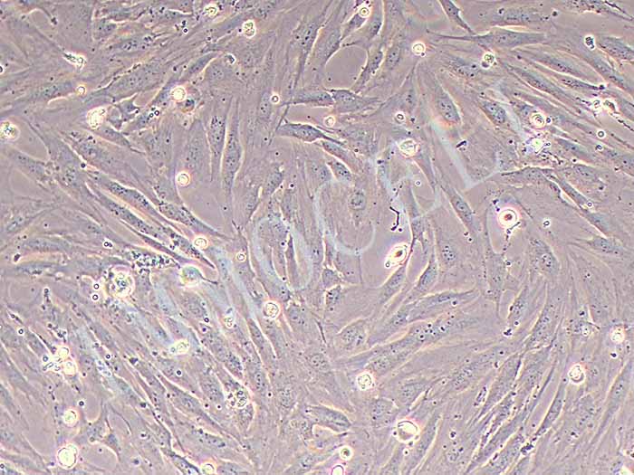人乳腺癌成纤维细胞永生化图片