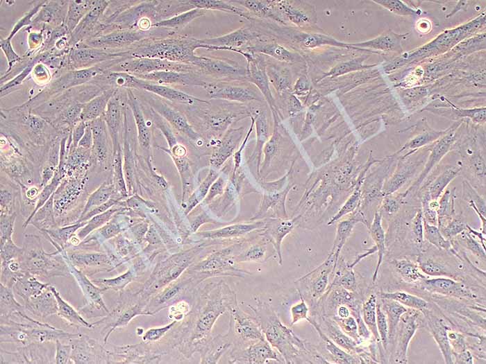 人乳腺癌成纤维细胞永生化（免疫荧光鉴定）