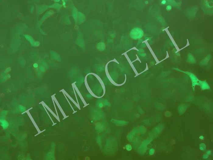 MCF-7-LUC-EGFP(人乳腺癌细胞-荧光素酶标记-绿色荧光蛋白（STR鉴定正确）)图片