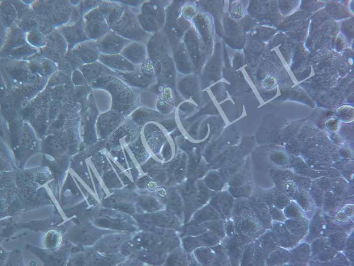 MHCC-97H-LUC-EGFP细胞图片