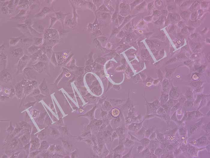 NCI-H1975-LUC-EGFP细胞图片