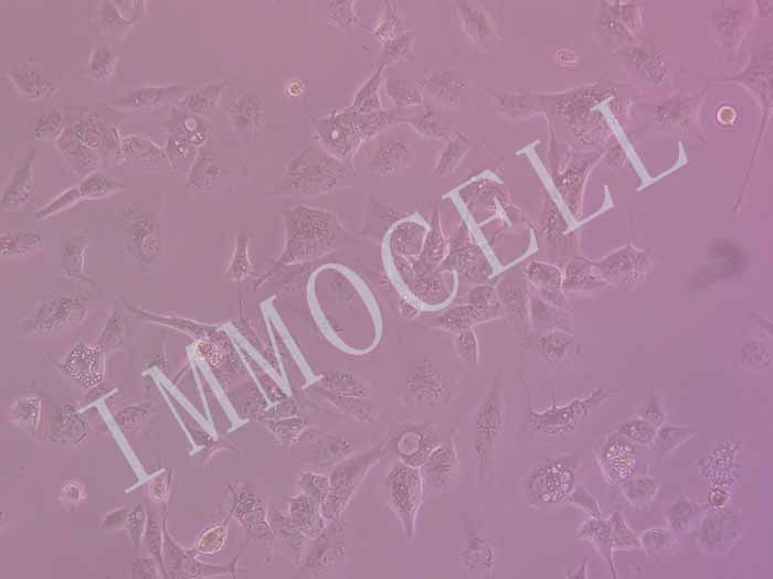 NCI-H1975-LUC-EGFP细胞图片