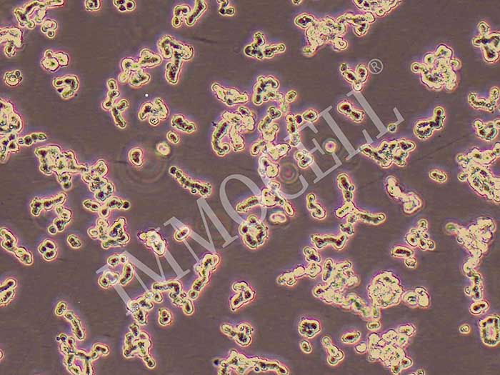 WERI-RB-1人视网膜神经胶质瘤细胞（STR鉴定正确）