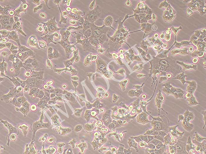 HEC-1-B人子宫内膜腺癌细胞（STR鉴定正确）