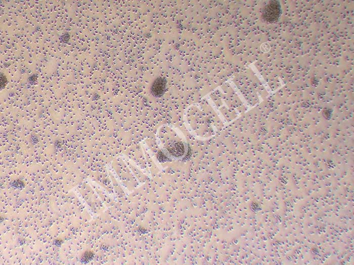 GM12878人B淋巴细胞