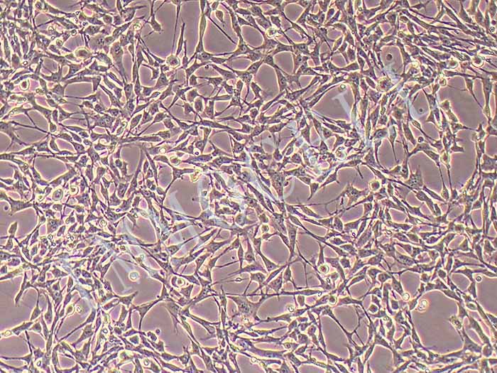 HSF人皮肤成纤维细胞（免疫荧光鉴定）图片