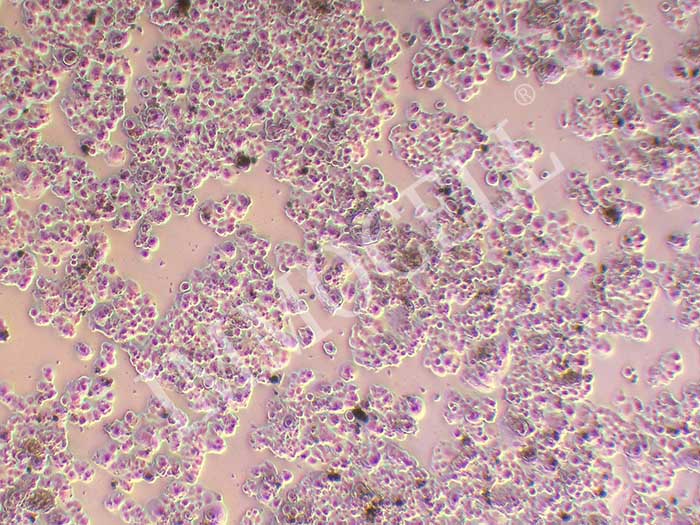 QGP-1人胰腺癌细胞